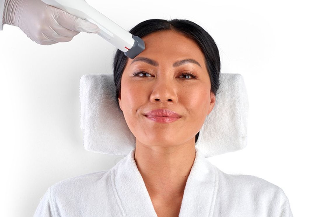 XERF, the Game-Changer in Non-Invasive Skin Tightening